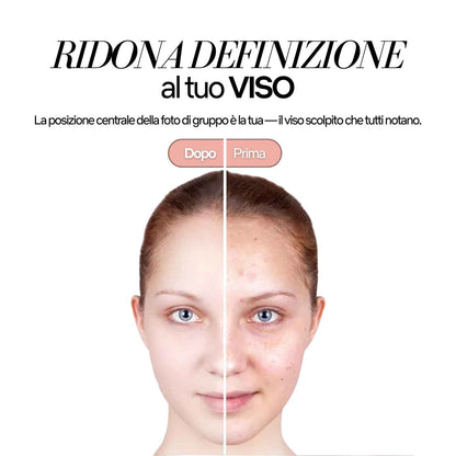 Massaggiatore Facciale RF & EMS con Massaggio 4D